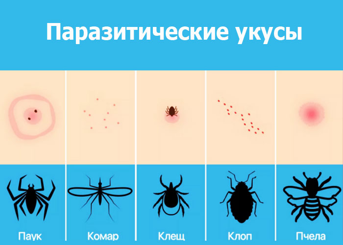 Паразитические укусы и их виды