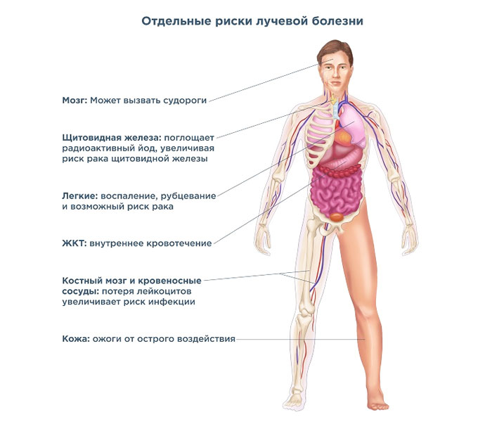Как ускорить восстановление ребенка после лучевой терапии