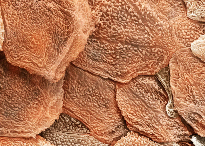 Домашняя пыль состоит из мёртвых клеток нашей кожи