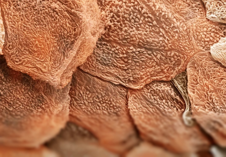 Домашняя пыль состоит из мёртвых клеток нашей кожи